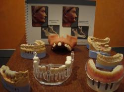 Implant Open Day 3 – Implant models