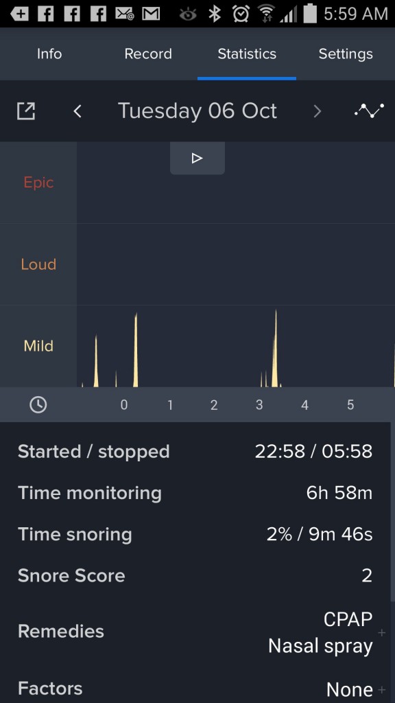 SnoreLab Stu_L After 061015