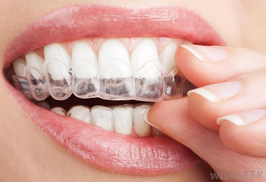 ways to get strong, healthy, straight teeth