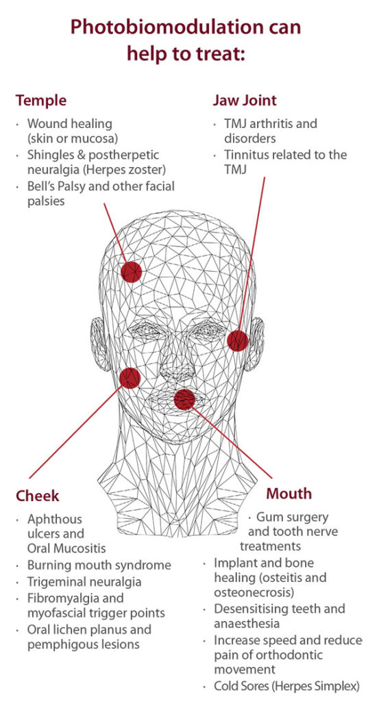 Photobiomodulation and Pain Management - Cosmic Smile Laser Dental