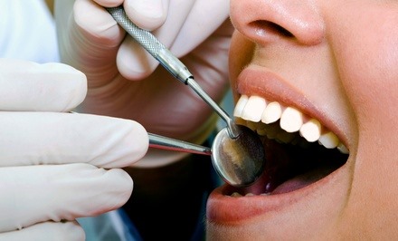Tooth removal services
