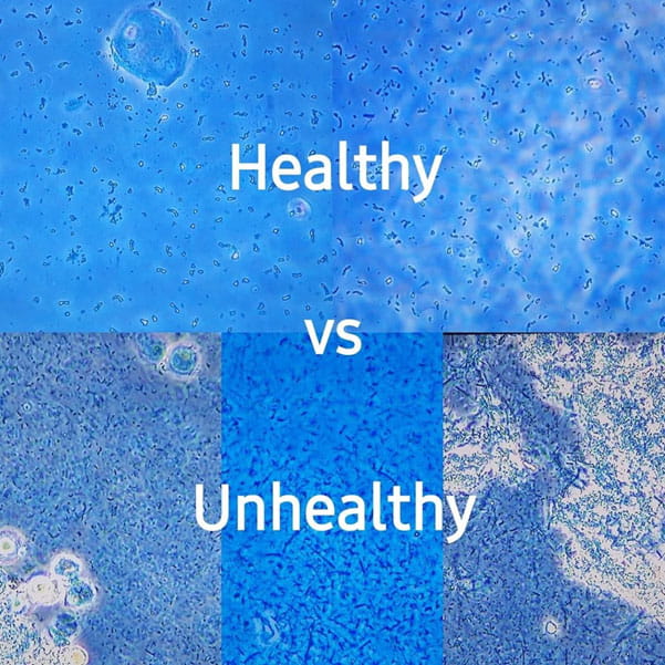healthy vs. unhealthy mouth