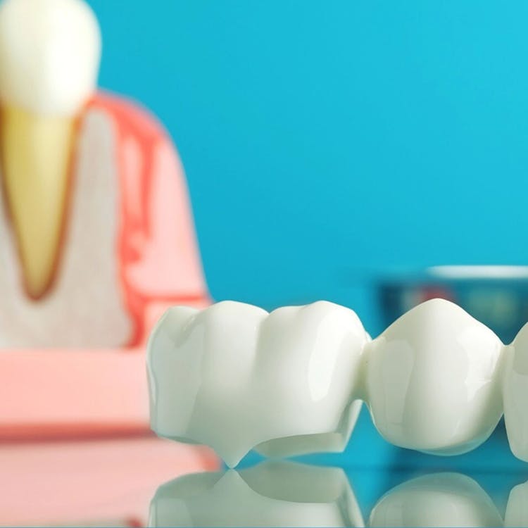 custom-fitted dentures in Sydney