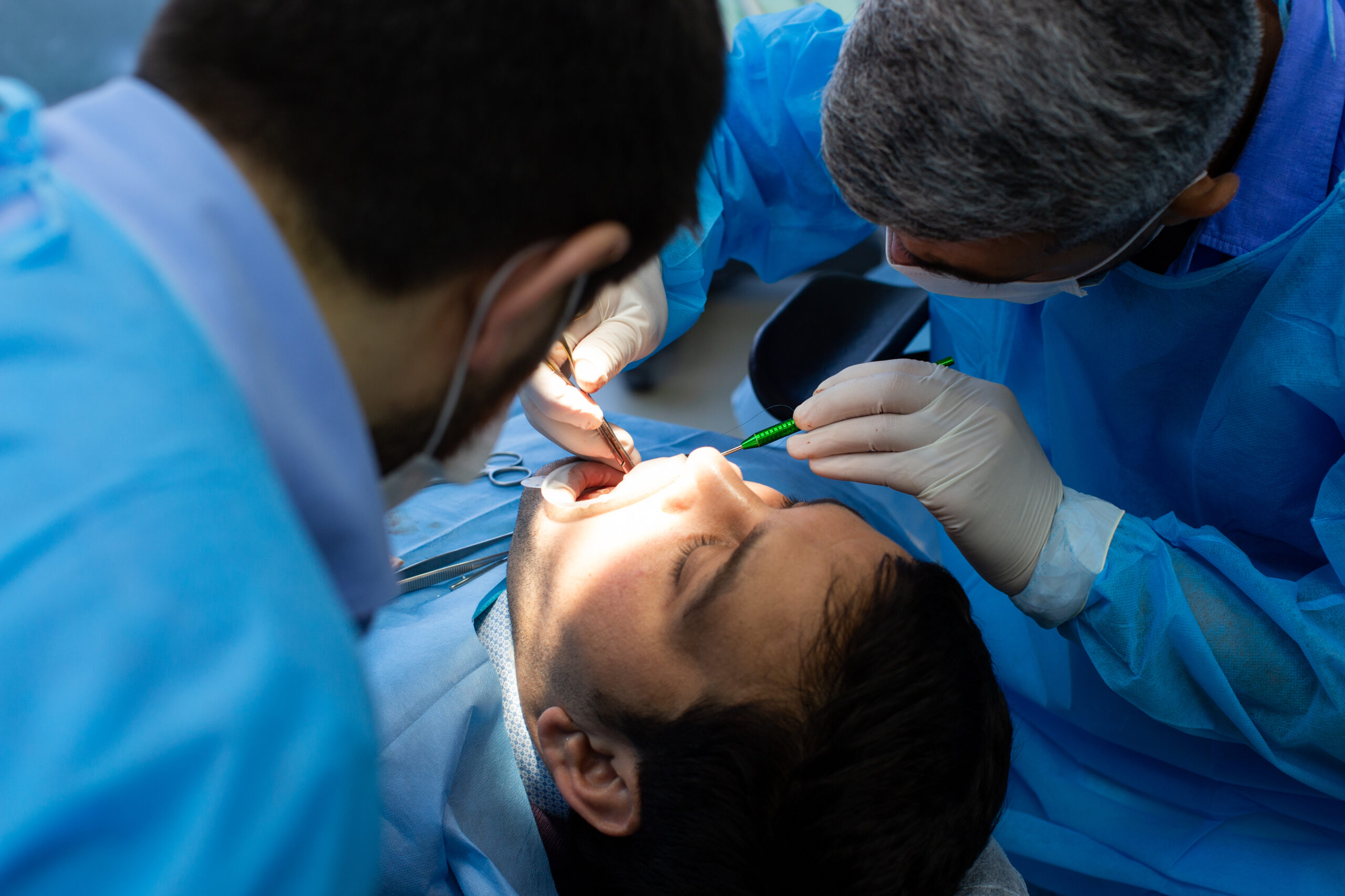 lingual frenectomy